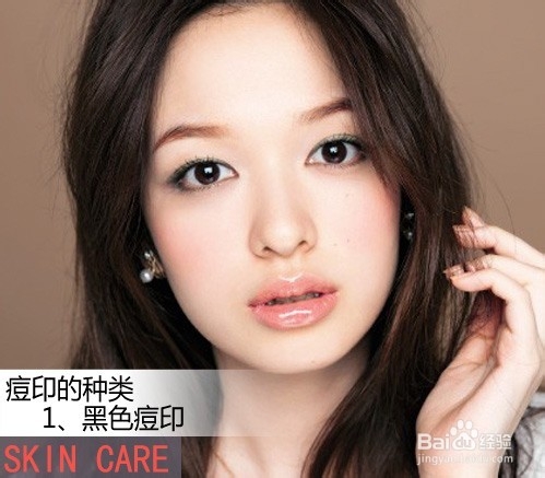 【消退痘印】 7个方法结合攻陷