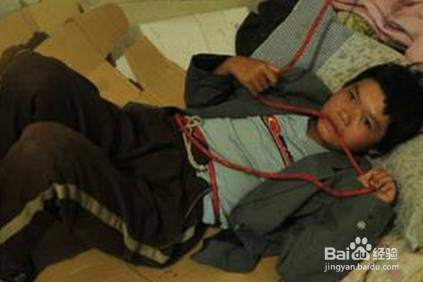 癫痫病怎么治疗