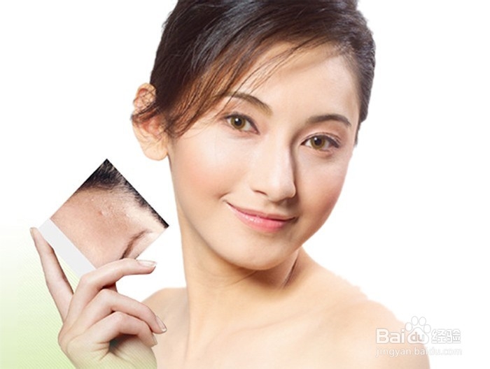 各年龄段如何去痘印美白