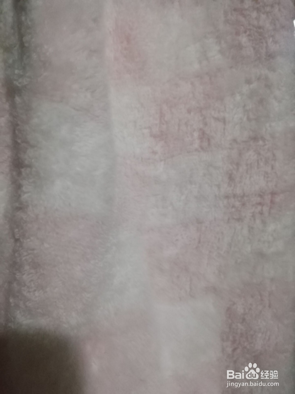唇炎患者日常怎么做保养