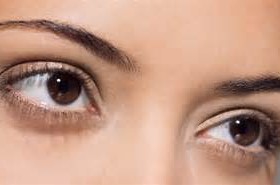 割双眼皮要注意那些?