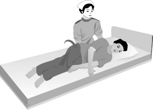 后背褥疮怎么办