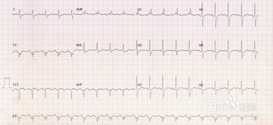 怀孕产检时间及主要项目