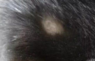 猫癣皮屑怎么处理？