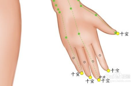 经外奇穴——十宣穴