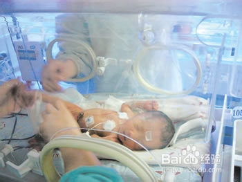 特殊体质的宝宝怎样添加辅食