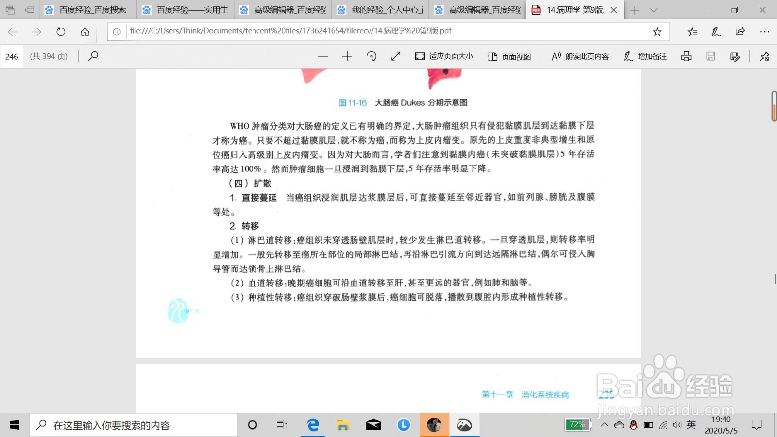 如何鉴别肠癌