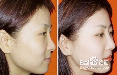 大家可以了解下美白针多少钱