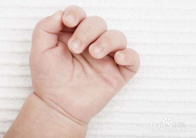 宝宝手指上起小水泡怎么办