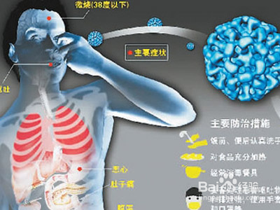 诺如病毒!你知多少?