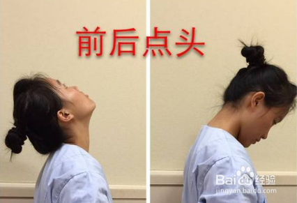 颈椎生理曲度变直的症状和预防方法