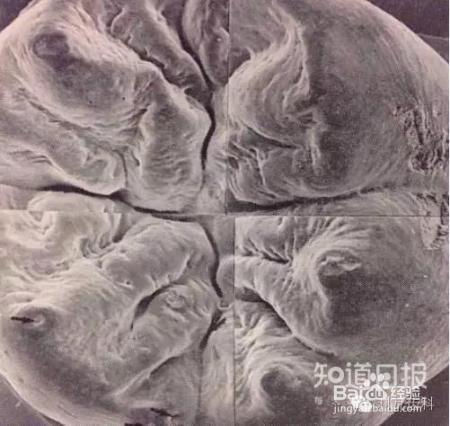 孩子六龄齿窝沟封闭有必要吗?九成父母都不知道