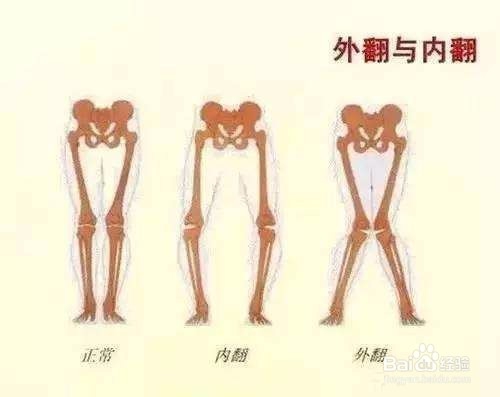 发现宝宝走路有这几个问题，你要开始注意咯