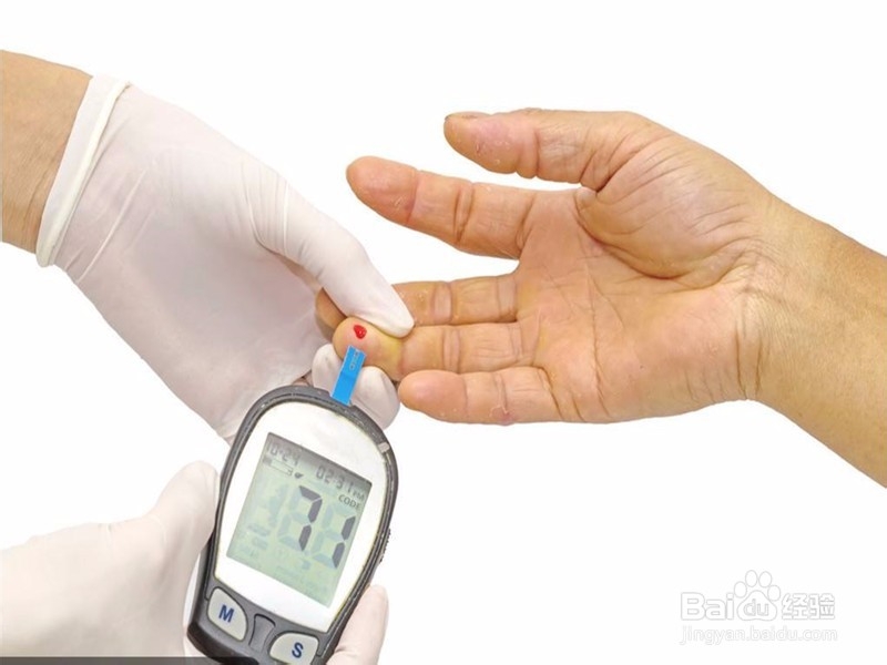 火锅涮羊肉4种人要注意，为什么？