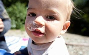 小儿鼻炎有何表现？