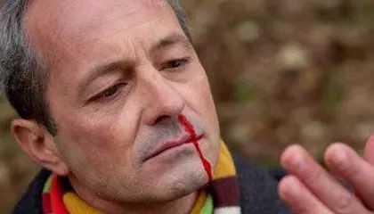 血栓发生前，身体会向你发送6个信号！