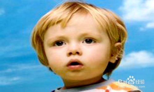 春季怎样防治腮腺炎？