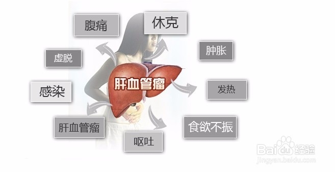 脂肪肝及常见的肝病预防