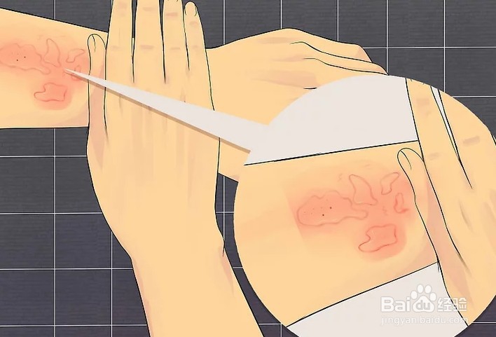 如何治疗皮肤过敏现象