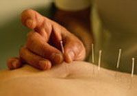 针灸减肥有效吗