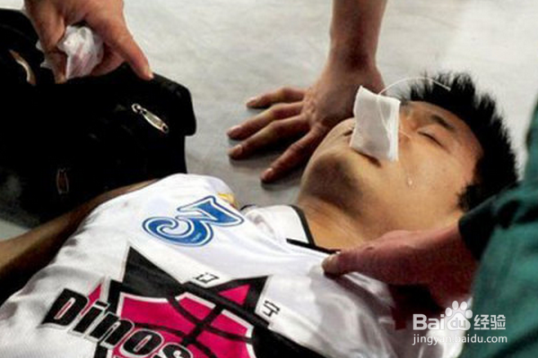 癫痫病怎么治疗