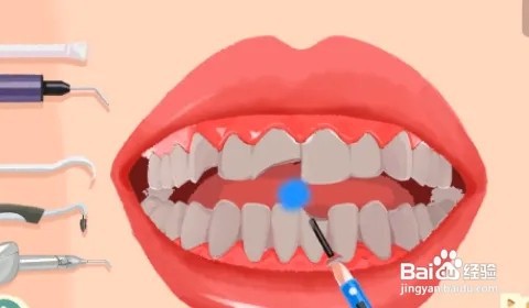 收纳物语口气清新通关攻略