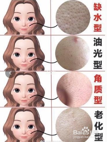 对症下药是关键,找对方法毛孔真的变小啦!