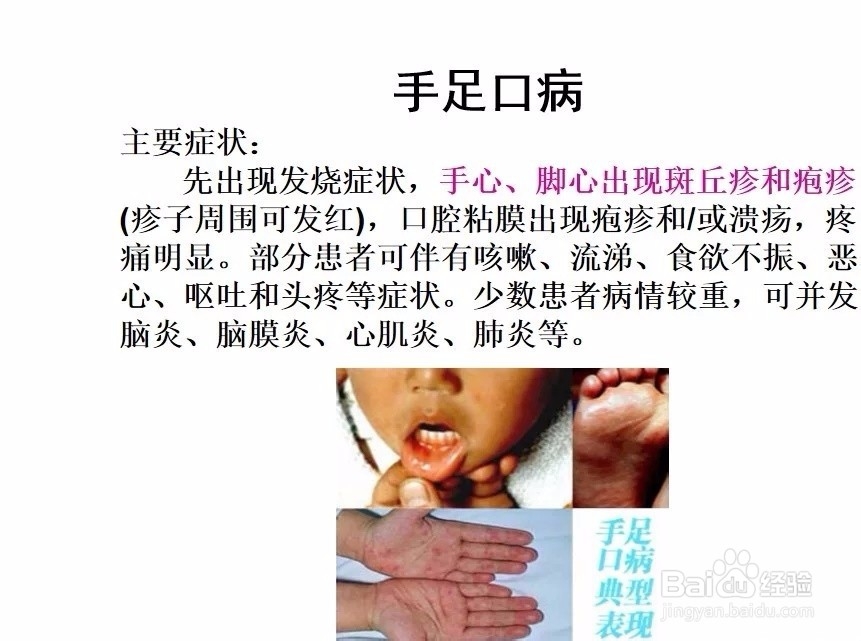 春季传染病有哪些,学生怎么预防