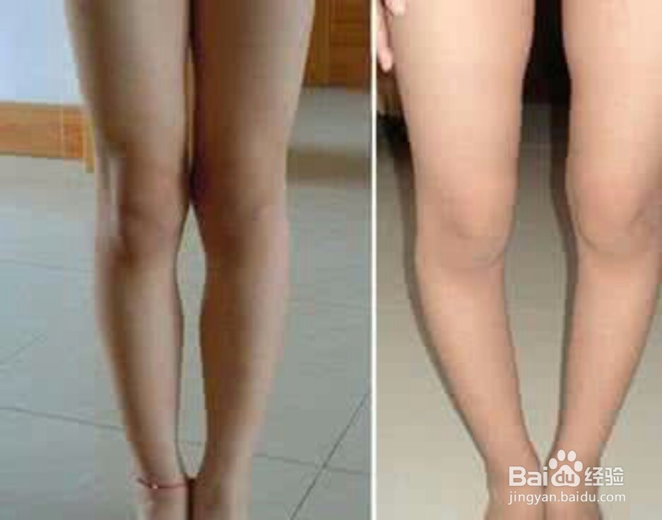 怎样变成大长腿呢？