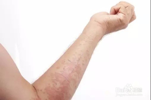 什么病看中医什么病看西医大家一起来了解