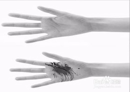 饭店吃饭小孩碰伤怎么理赔