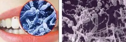 花钱洗一次牙,到底值不值?