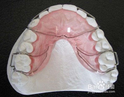 保持器分几种？