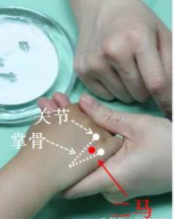 鹅口疮的推拿调理手法,适合婴幼儿