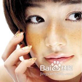 怎样去晒斑【组图】