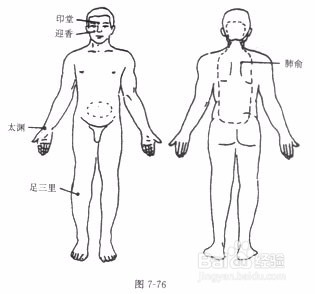 砭石治疗过敏性鼻炎手法解读