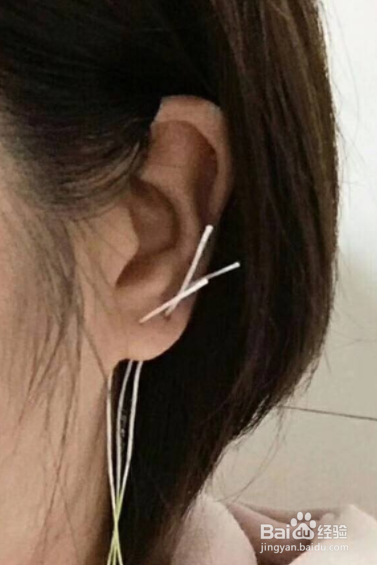 耳洞长死了怎么通开