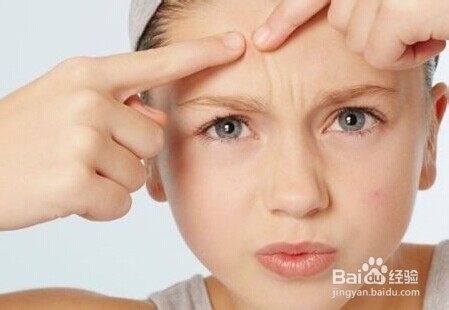 哪些人容易长痘痘