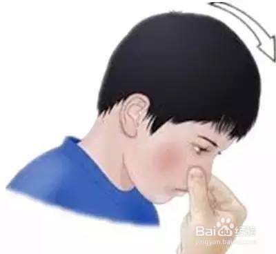 孩子常流鼻血怎么办?