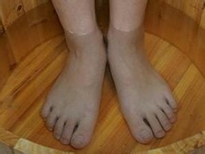 冬天防止冻疮小知识