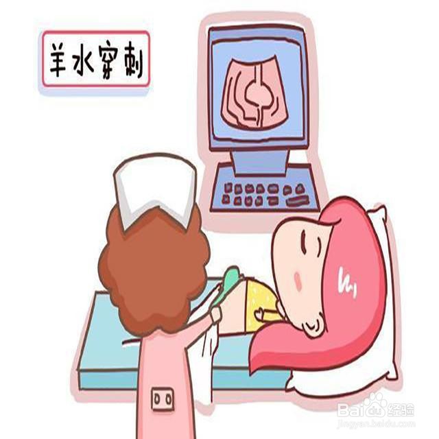 唐筛通过率低,不如直接做羊水穿刺