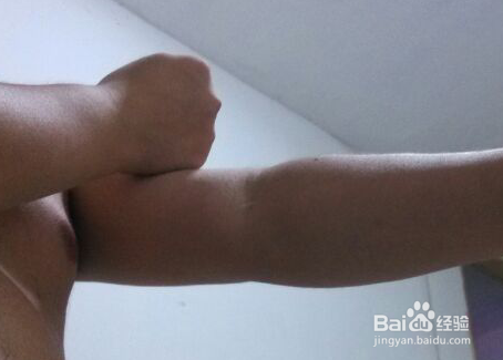 敲大肠经治便秘