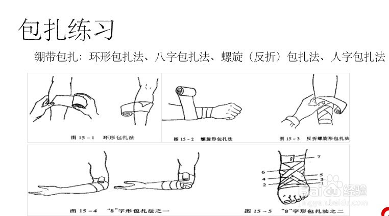 出血分类及止血、包扎