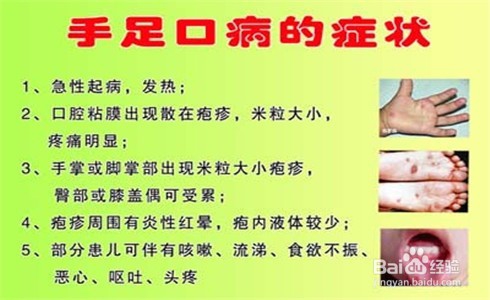 手足口病如何预防护理