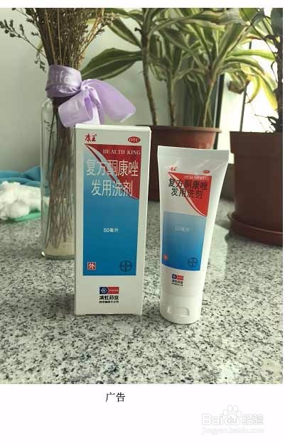 怎么去头皮屑你现在用的方法真的管用吗