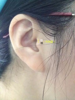 嗓子疼如何应用中医疗法