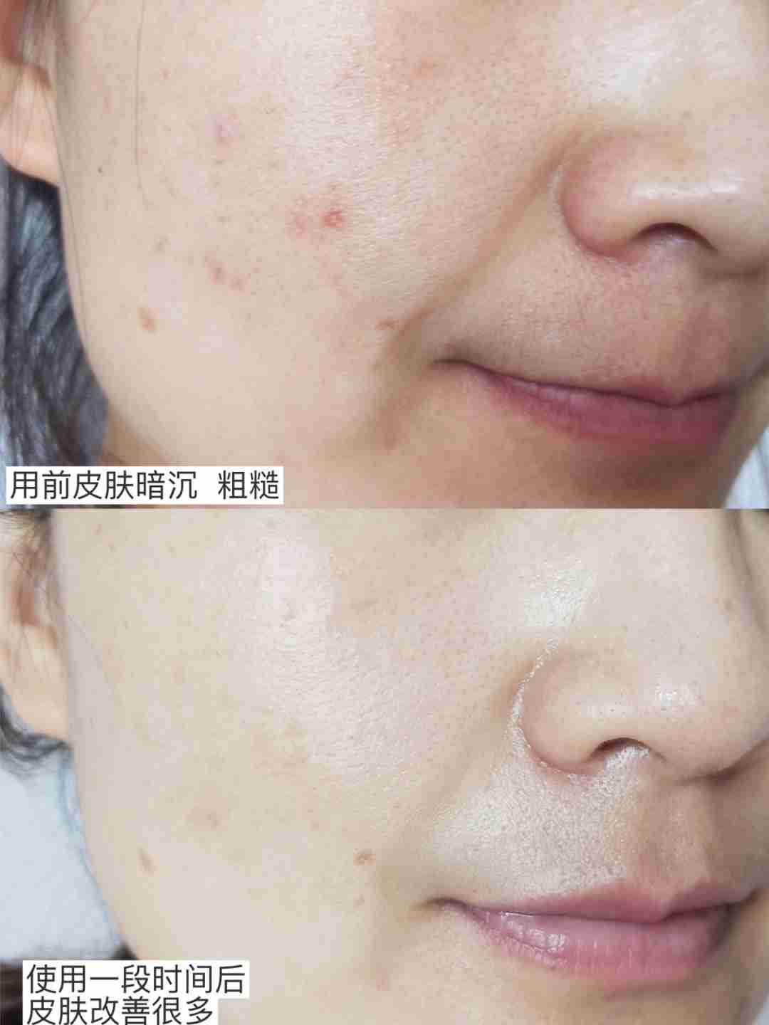 粗糙皮必用它——香娜露儿香粉羊胎素精华液