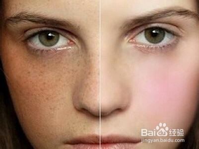 脸上色斑是什么引起的