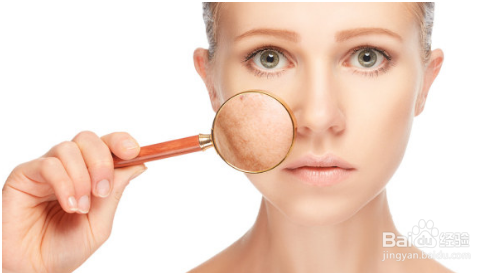 过了青春期还一直长很多痘痘怎么办