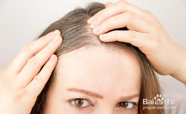 白发是怎样引起的,出现白发的原因有哪些 ?